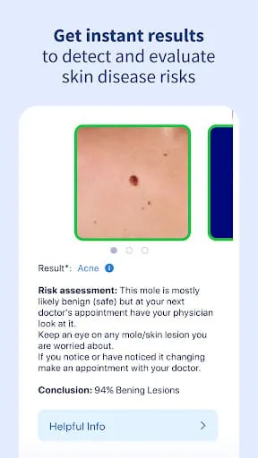 AI Dermatologist: Skin Scanner