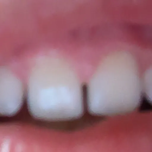 JNGUL