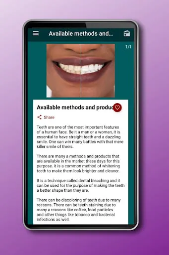 How to Whiten Teeth at home